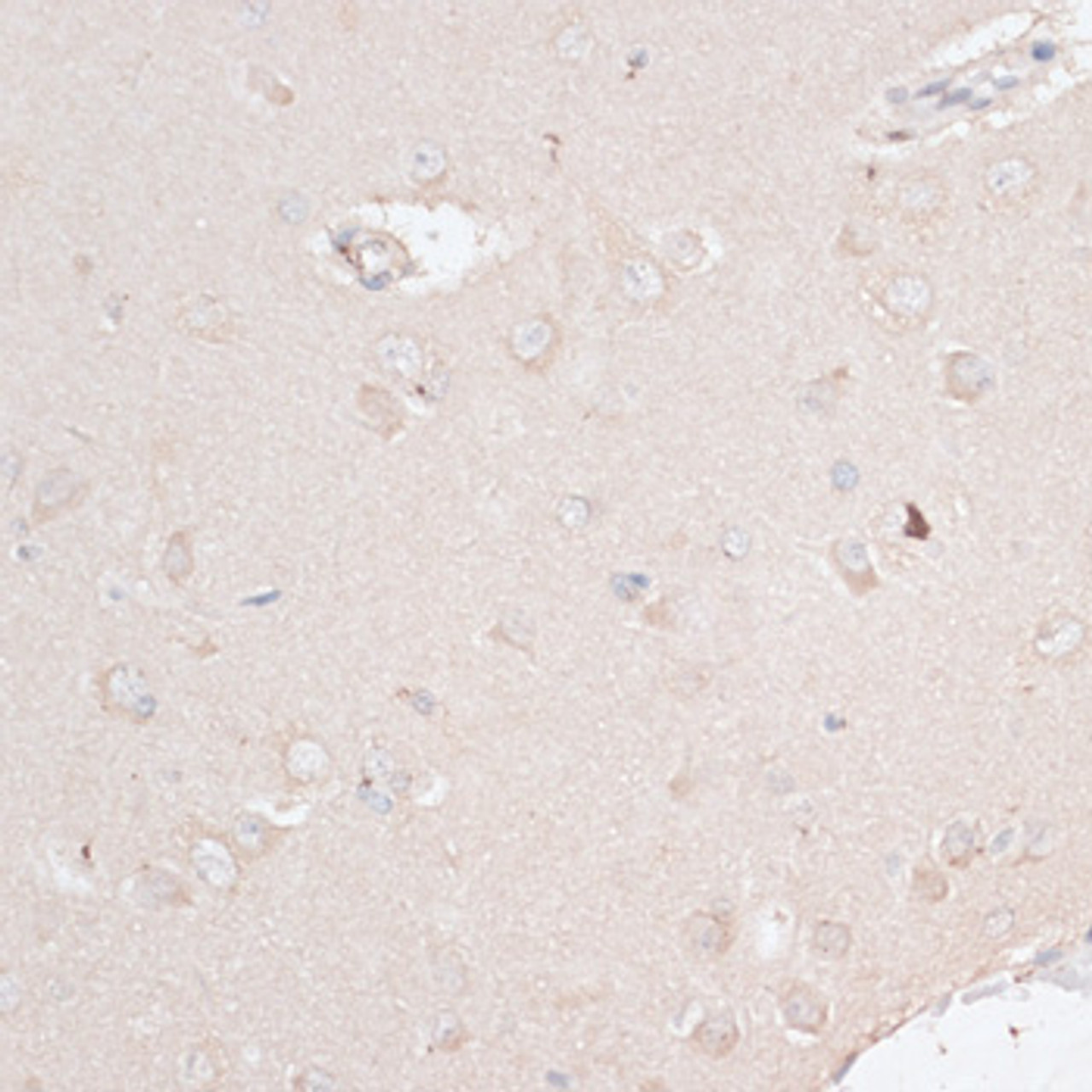 Immunohistochemistry of paraffin-embedded Rat brain using ABCF2 Polyclonal Antibody at dilution of  1:100 (40x lens).