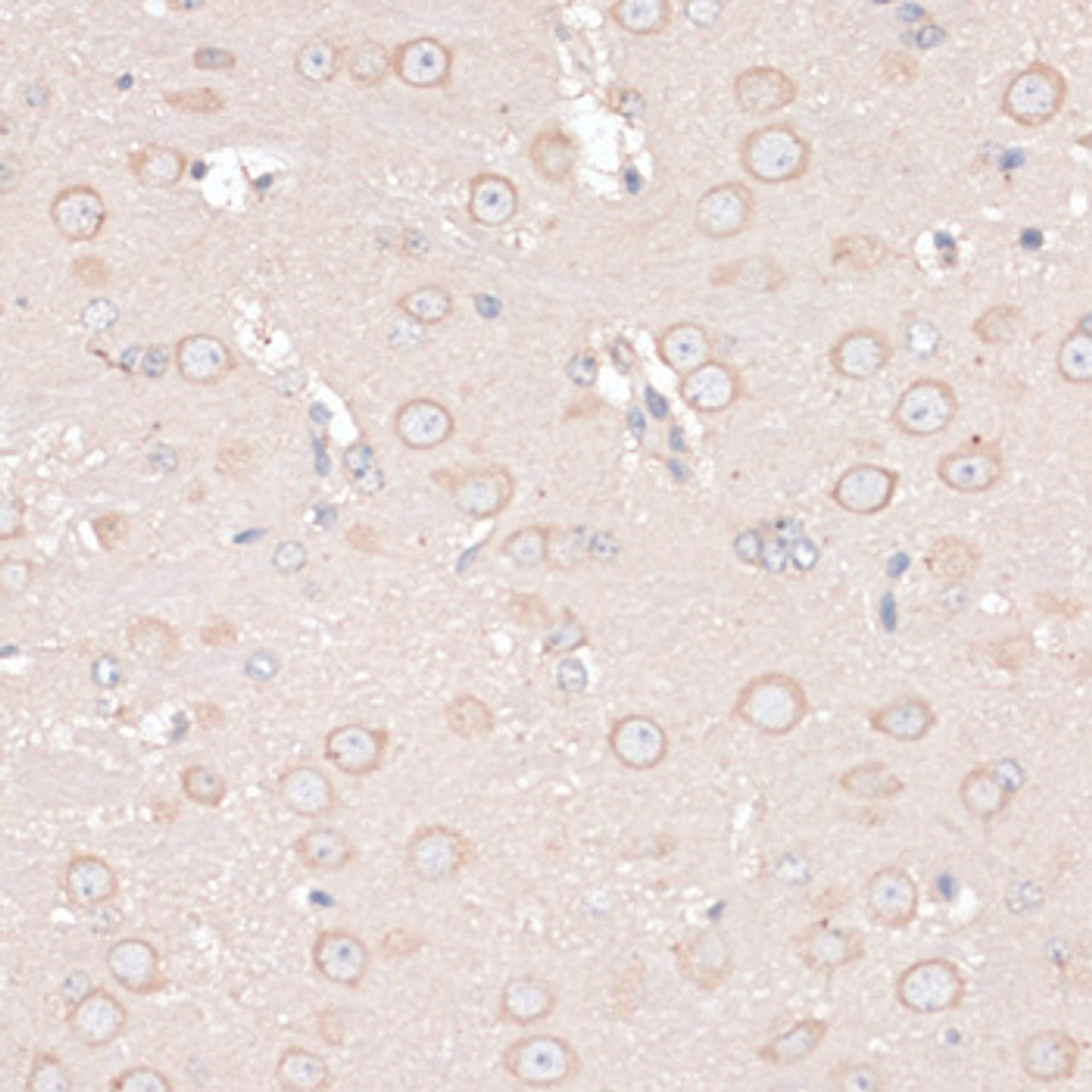 Immunohistochemistry of paraffin-embedded Mouse brain using ABCF2 Polyclonal Antibody at dilution of  1:100 (40x lens).