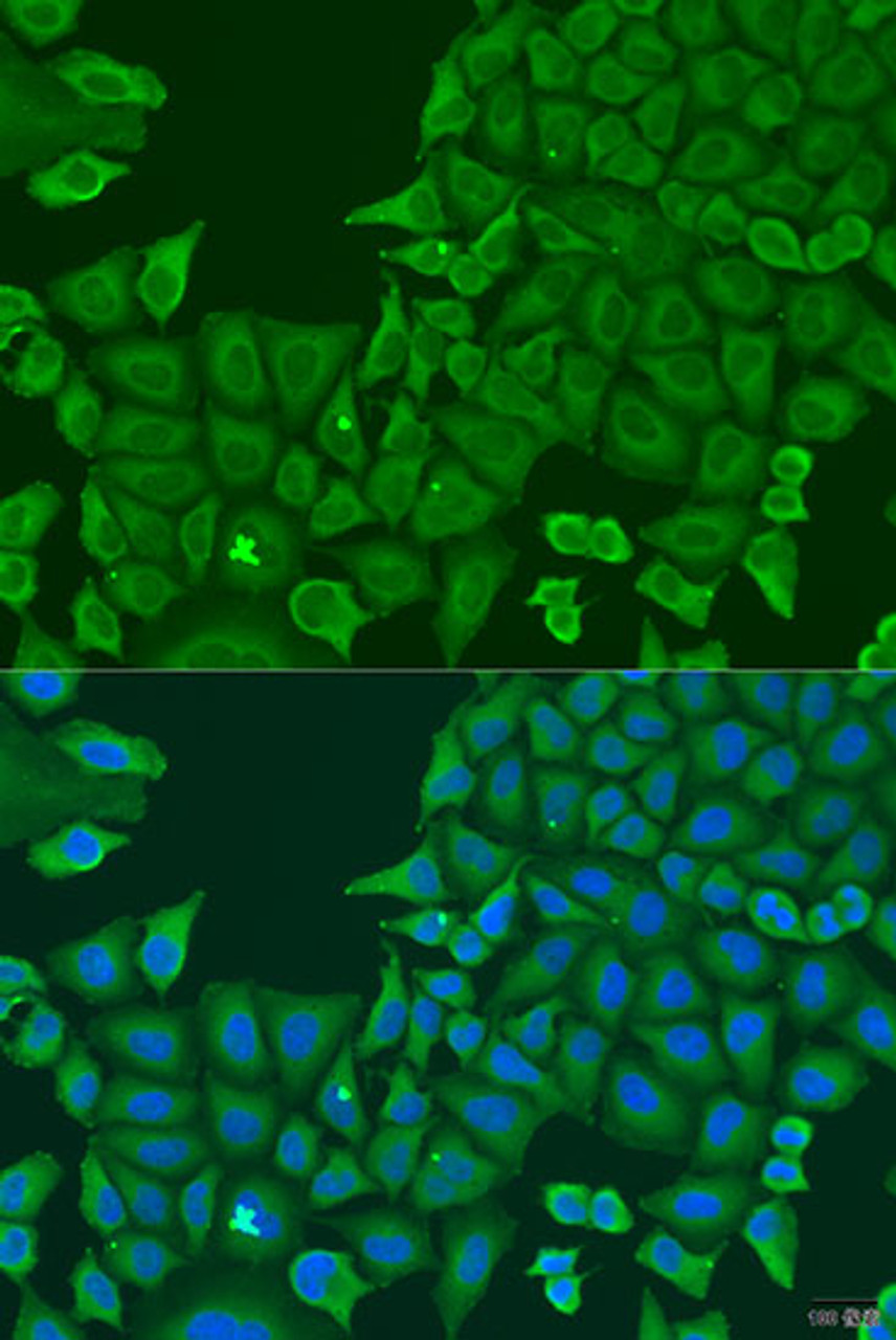 Immunofluorescence analysis of U2OS cells using ABCF2 Polyclonal Antibody at dilution of  1:100. Blue: DAPI for nuclear staining.