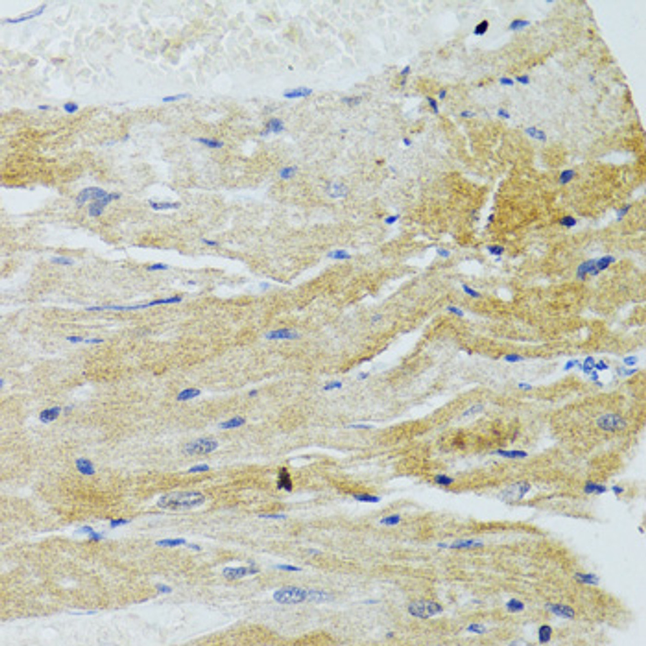 Immunohistochemistry of paraffin-embedded Rat heart using MOAP1 Polyclonal Antibody at dilution of  1:100 (40x lens).