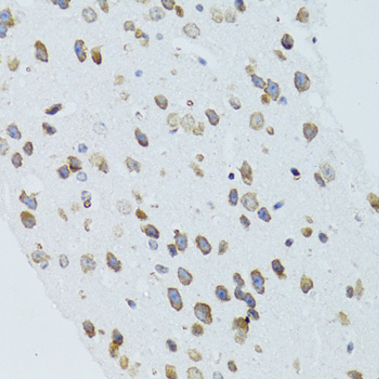 Immunohistochemistry of paraffin-embedded Mouse brain using MOAP1 Polyclonal Antibody at dilution of  1:100 (40x lens).