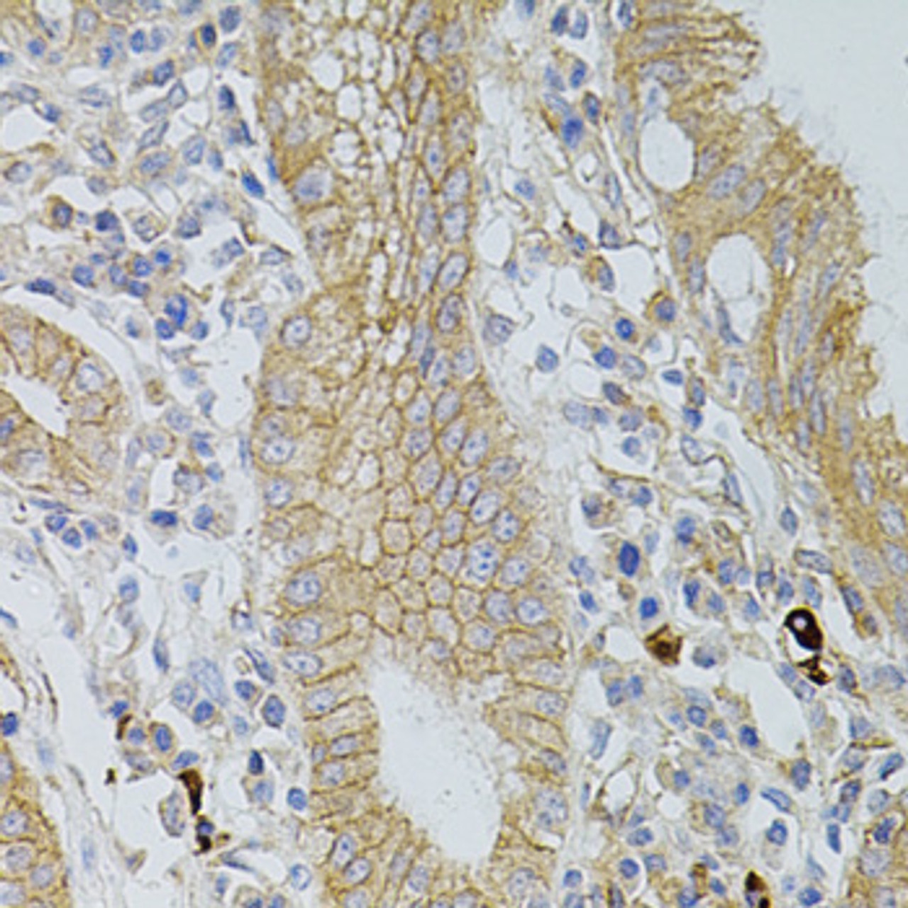 Immunohistochemistry of paraffin-embedded Human stomach using Occludin Polyclonal Antibody at dilution of  1:100 (40x lens).