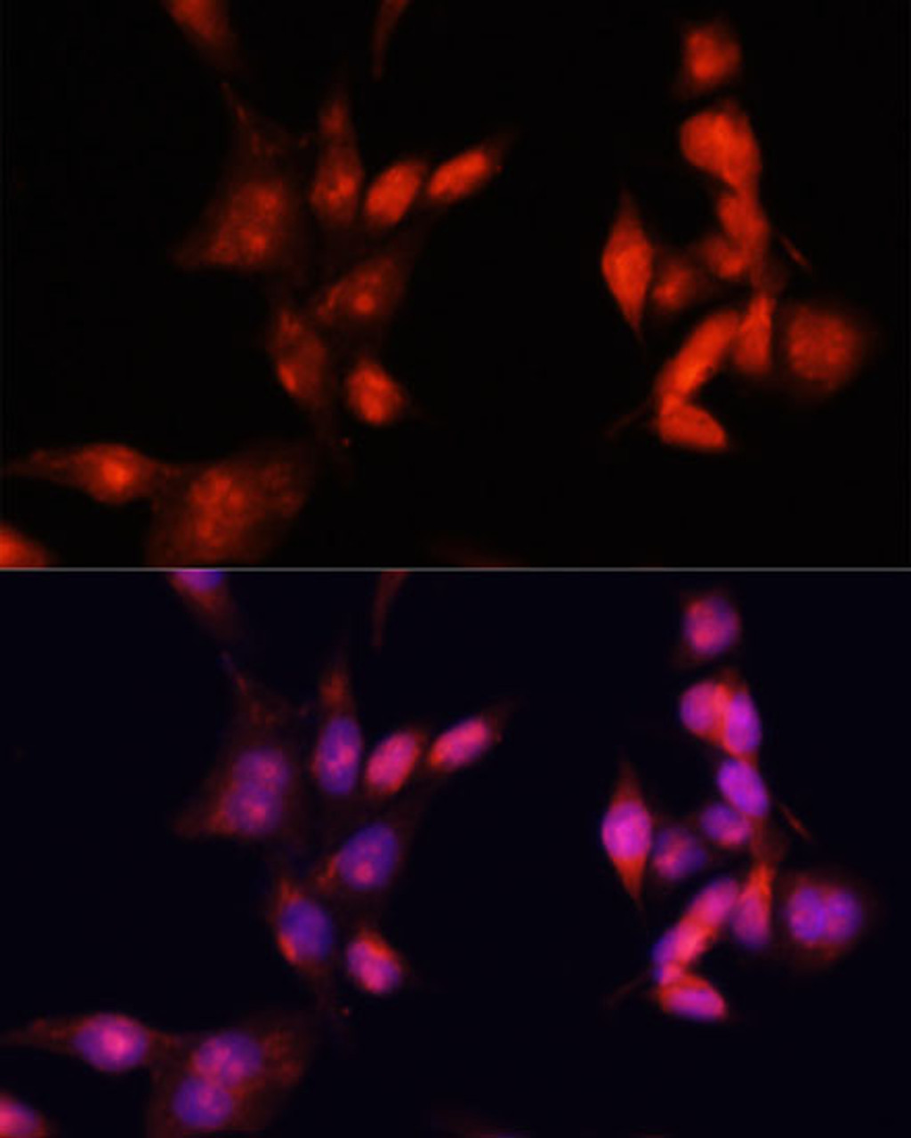 Immunofluorescence analysis of HeLa cells using IRAK1 Polyclonal Antibody at dilution of  1:100. Blue: DAPI for nuclear staining.