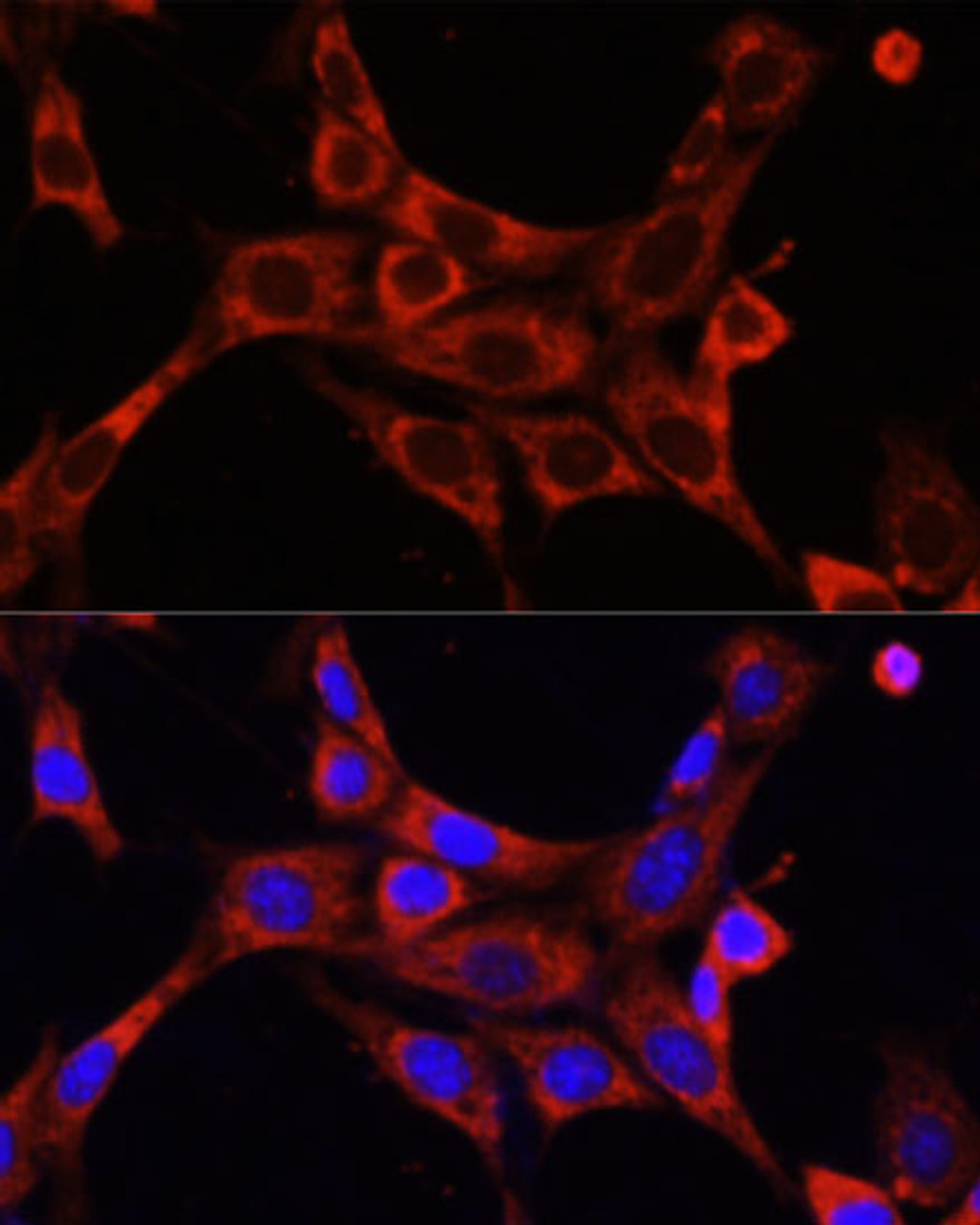 Immunofluorescence analysis of NIH/3T3 cells using IRAK1 Polyclonal Antibody at dilution of  1:100. Blue: DAPI for nuclear staining.