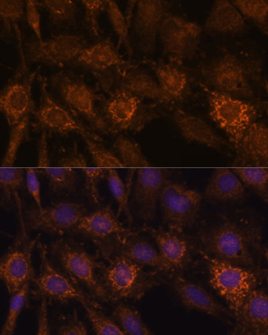 Immunofluorescence analysis of C6 cells using HIBADH Polyclonal Antibody at dilution of  1:100. Blue: DAPI for nuclear staining.