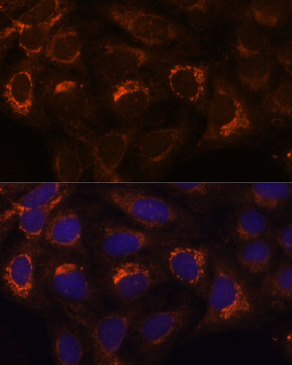 Immunofluorescence analysis of U-2 OS cells using HIBADH Polyclonal Antibody at dilution of  1:100. Blue: DAPI for nuclear staining.