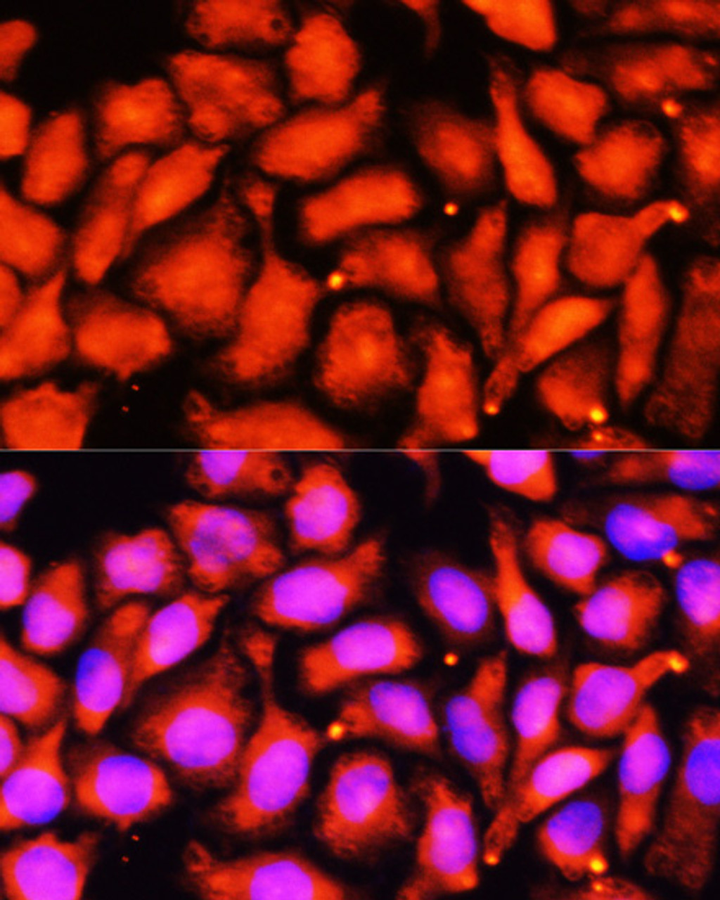 Immunofluorescence analysis of HeLa cells using ACADL Polyclonal Antibody at dilution of  1:100 (40x lens). Blue: DAPI for nuclear staining.