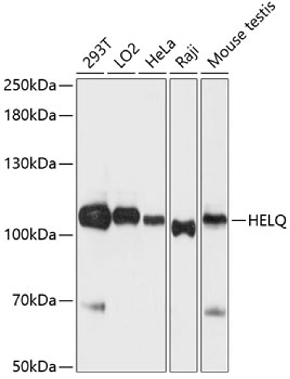Western blot analysis of extracts of various cell lines using HEL308 Polyclonal Antibody at dilution of 1:3000.