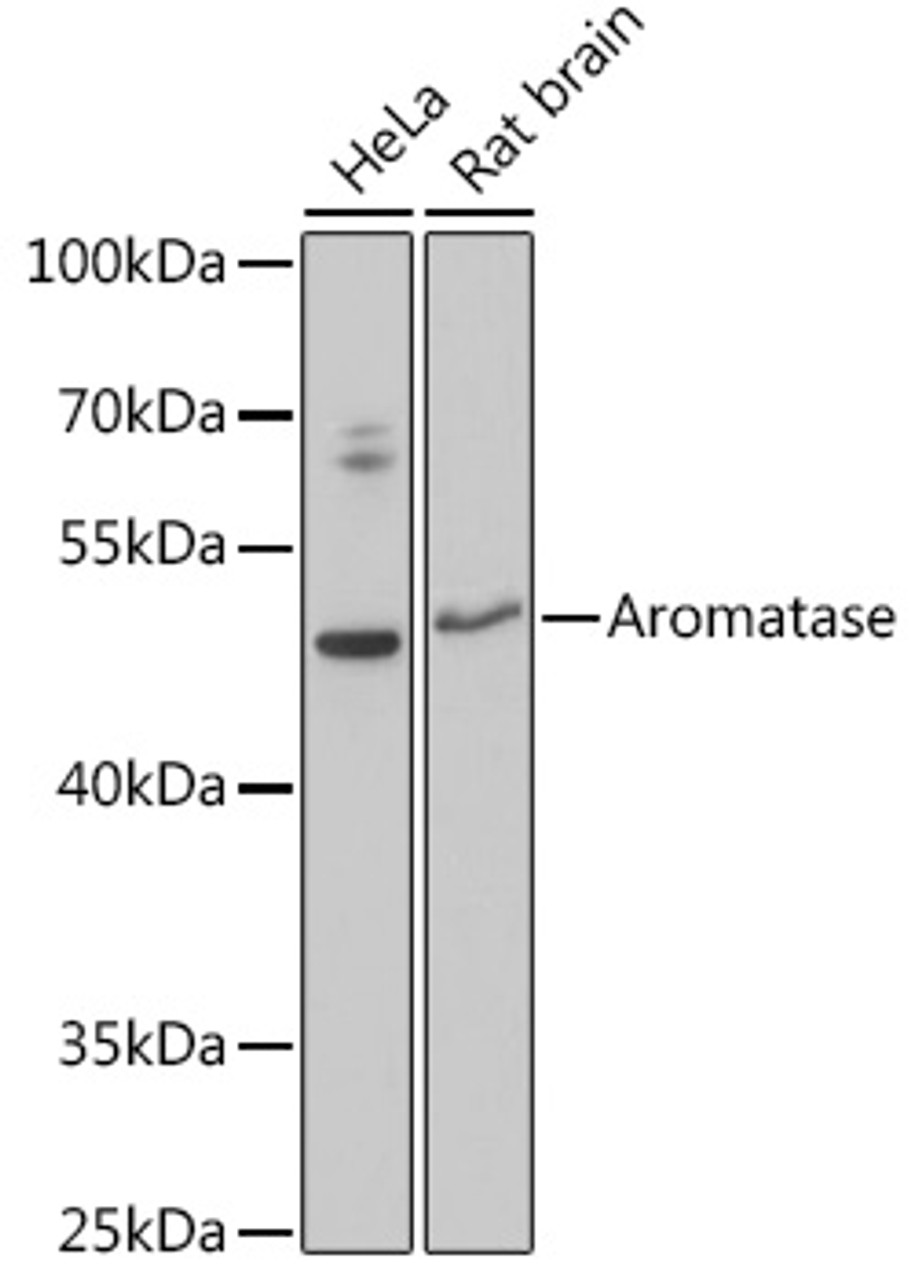 Western blot analysis of extracts of various cell lines using Aromatase Polyclonal Antibody at dilution of 1:3000.