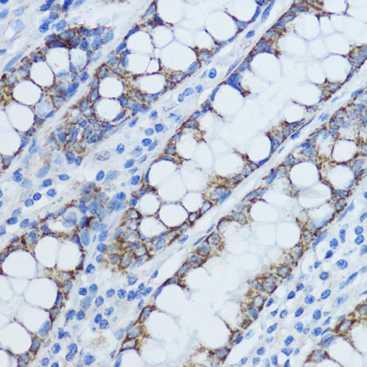 Immunohistochemistry of paraffin-embedded Human colon using Aromatase Polyclonal Antibody at dilution of  1:100 (40x lens).