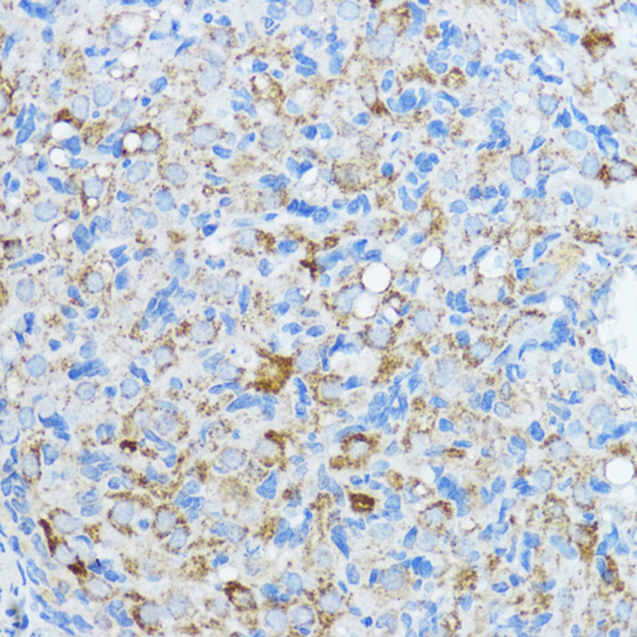 Immunohistochemistry of paraffin-embedded Rat ovary using Aromatase Polyclonal Antibody at dilution of  1:100 (40x lens).