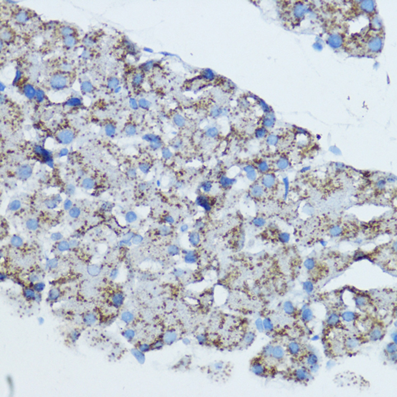 Immunohistochemistry of paraffin-embedded Rat pancreas using Aromatase Polyclonal Antibody at dilution of  1:100 (40x lens).