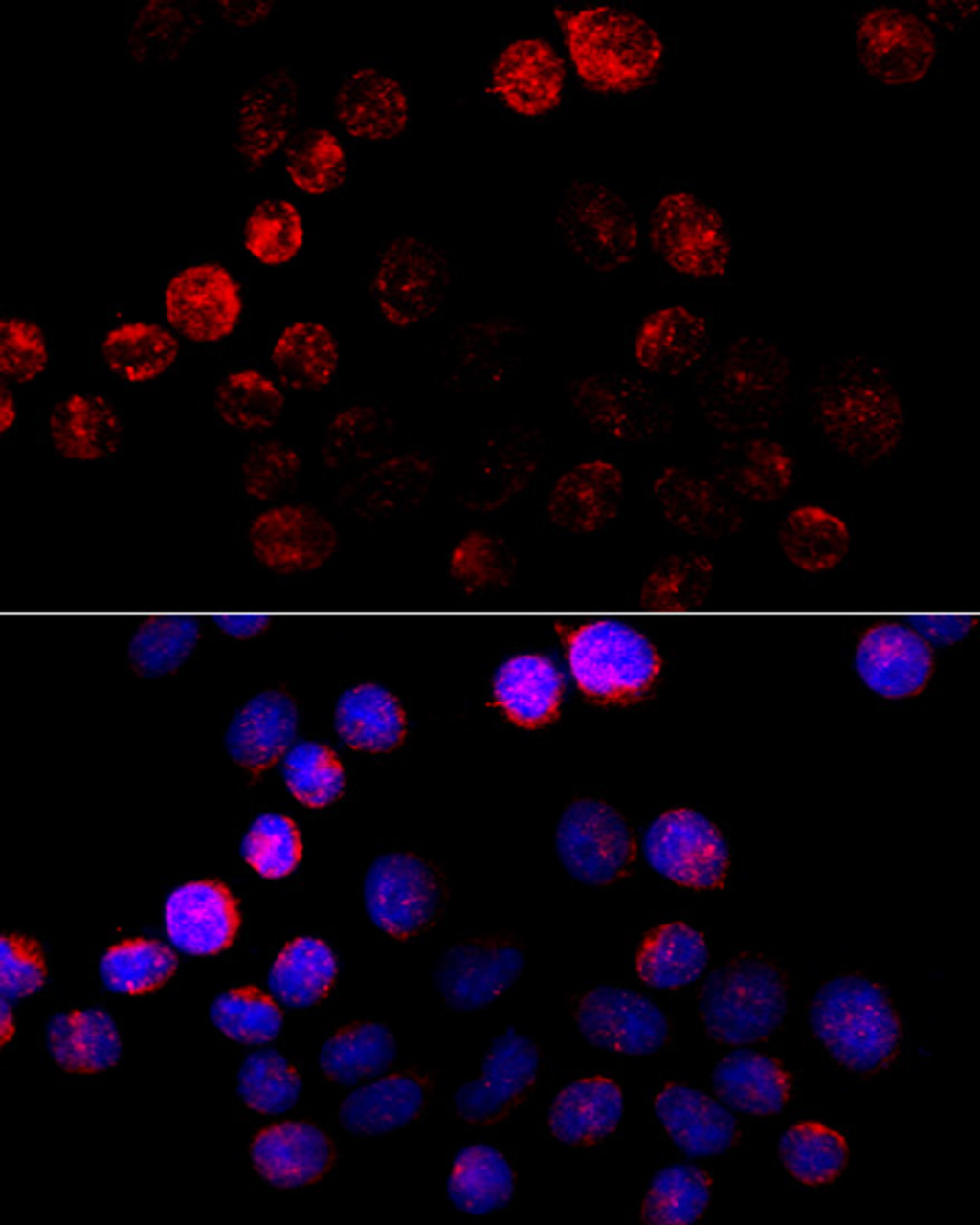 Immunofluorescence analysis of HeLa cells using Aromatase Polyclonal Antibody at dilution of  1:100 (40x lens). Blue: DAPI for nuclear staining.