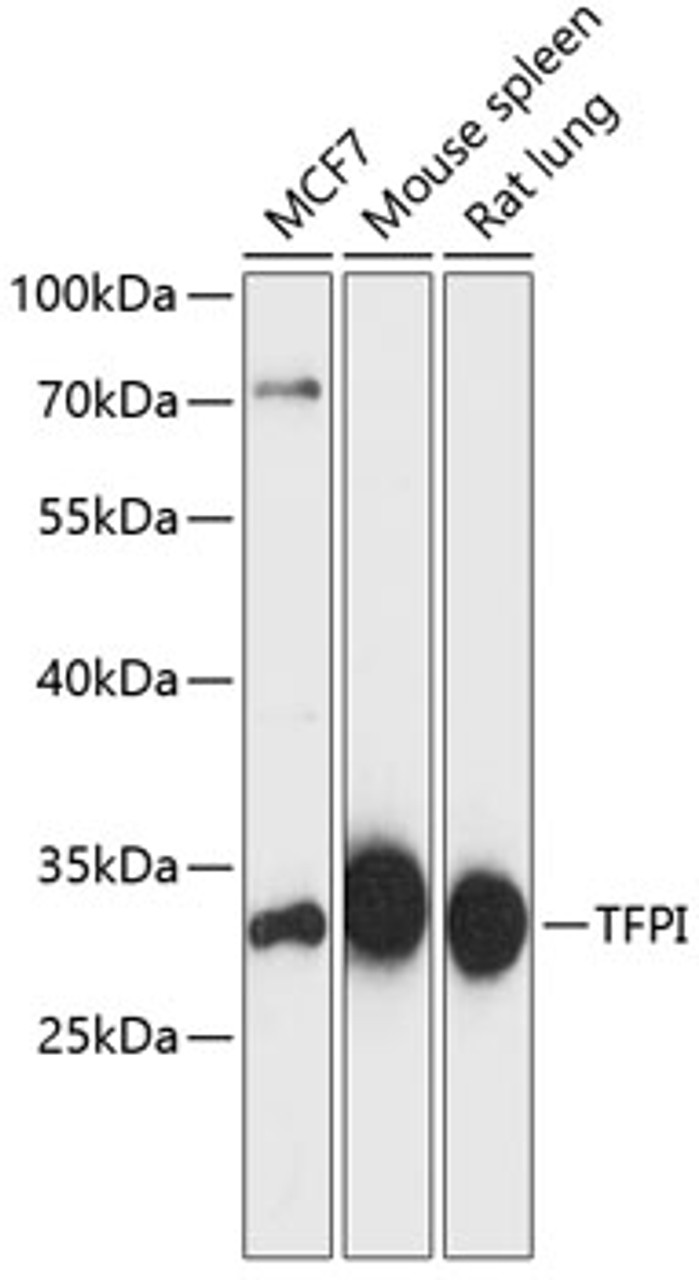 Western blot analysis of extracts of various cell lines using TFPI Polyclonal Antibody at dilution of 1:3000.