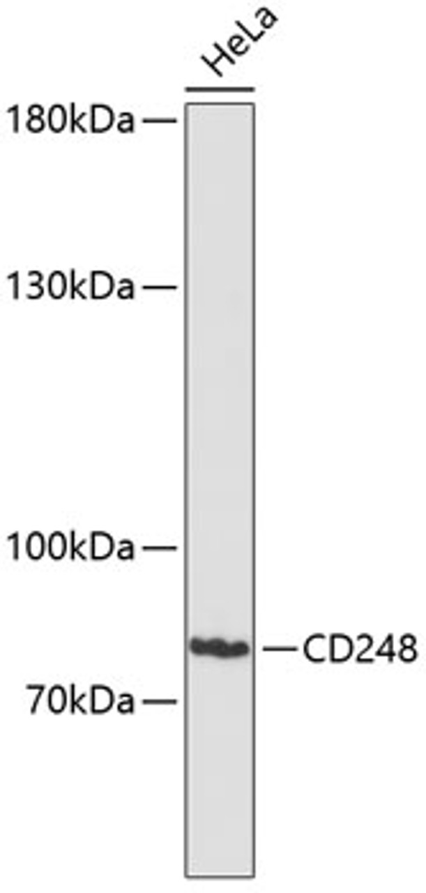 Western blot analysis of extracts of HeLa cells using CD248 Polyclonal Antibody at dilution of 1:3000.