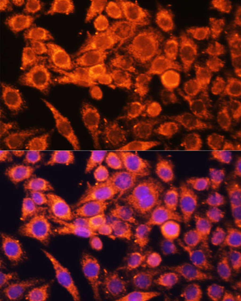Immunofluorescence analysis of HeLa cells using AMPKa1/AMPKa2 Polyclonal Antibody at dilution of  1:100 (40x lens). Blue: DAPI for nuclear staining.