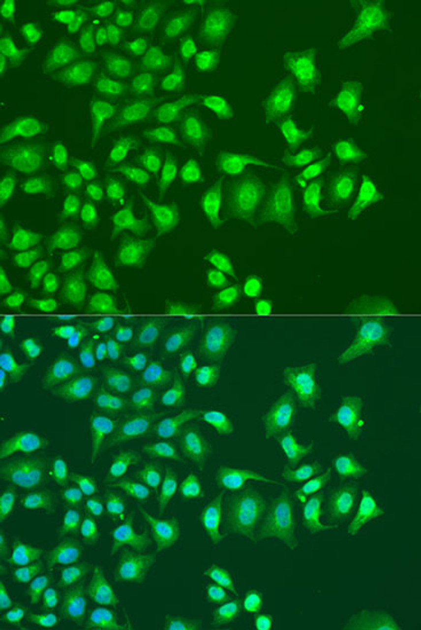 Immunofluorescence analysis of U2OS cells using NIN Polyclonal Antibody at dilution of  1:100. Blue: DAPI for nuclear staining.