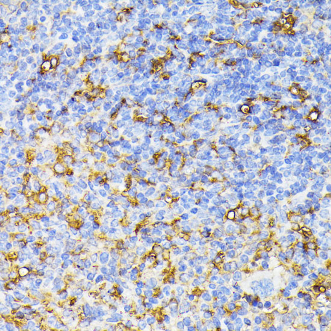 Immunohistochemistry of paraffin-embedded Mouse spleen using VEGF Receptor 1 Polyclonal Antibody at dilution of  1:100 (40x lens).
