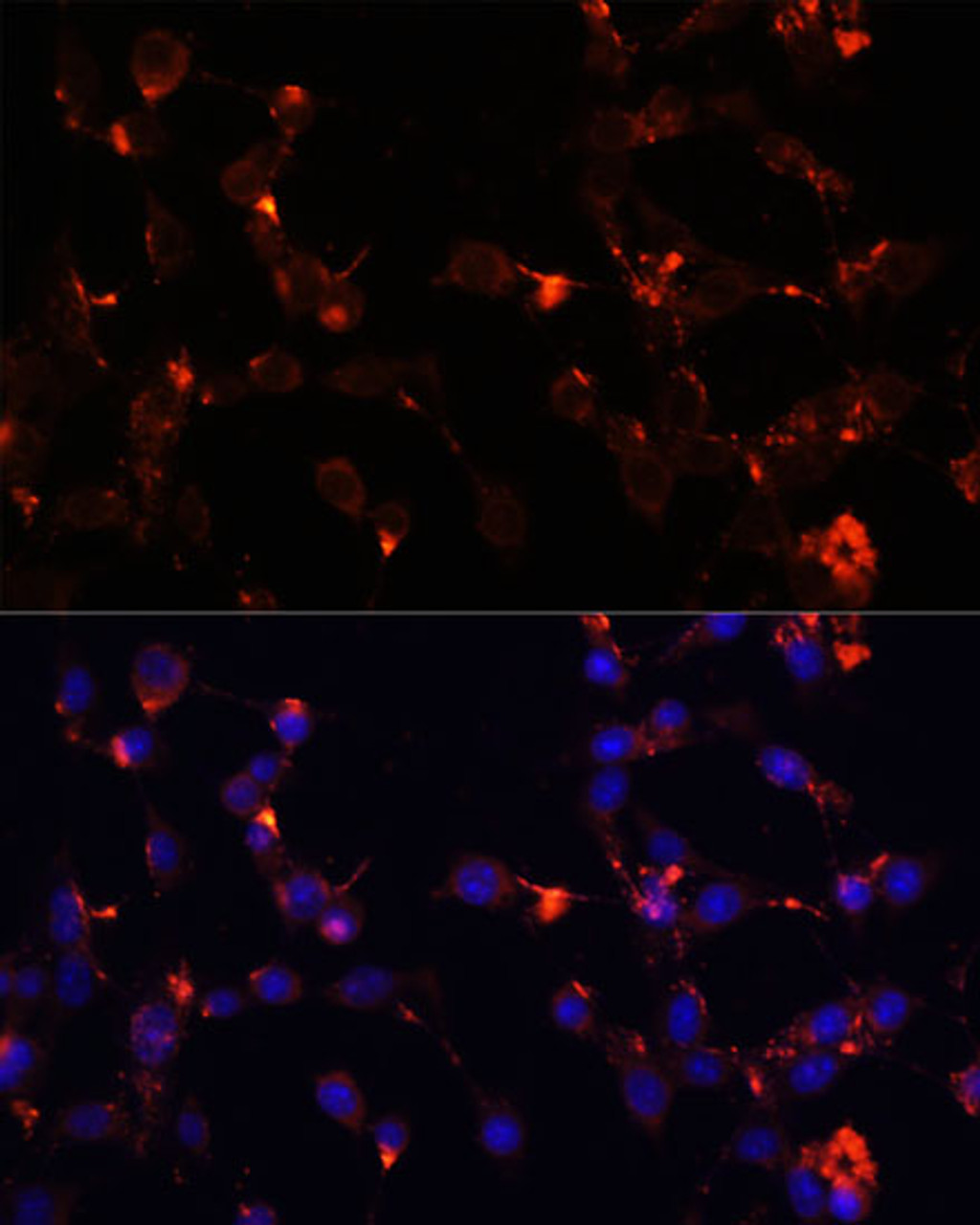 Immunofluorescence analysis of NIH/3T3 cells using WDR81 Polyclonal Antibody at dilution of  1:100. Blue: DAPI for nuclear staining.
