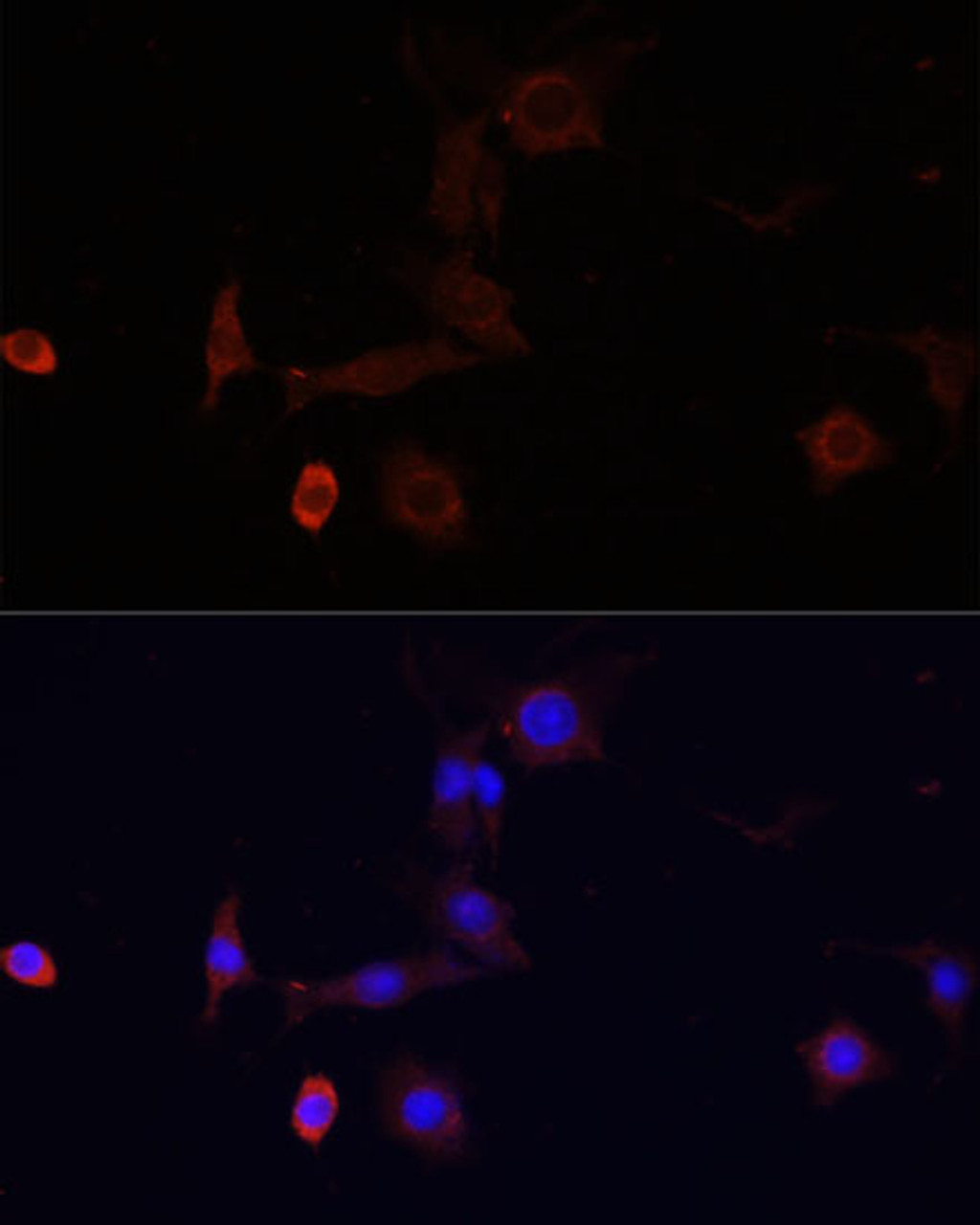 Immunofluorescence analysis of PC12 cells using WDR81 Polyclonal Antibody at dilution of  1:100. Blue: DAPI for nuclear staining.