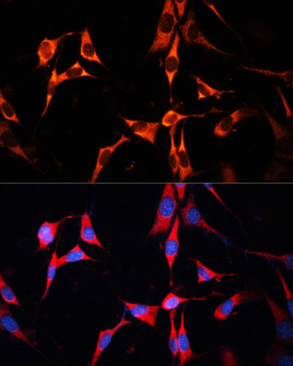 Immunofluorescence analysis of NIH/3T3 cells using RAB7A Polyclonal Antibody at dilution of  1:100. Blue: DAPI for nuclear staining.