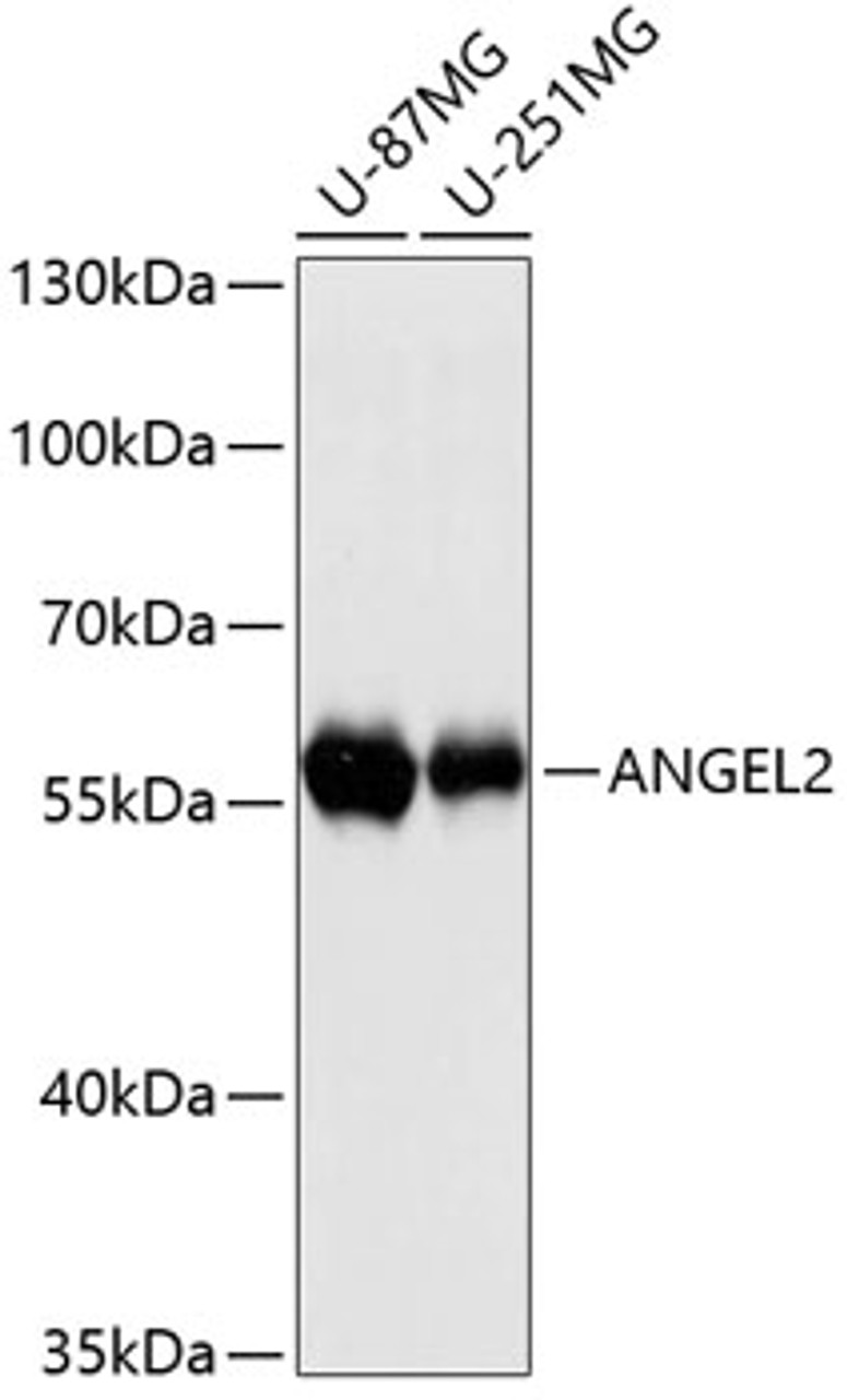 Western blot analysis of extracts of various cell lines using ANGEL2 Polyclonal Antibody at dilution of 1:3000.