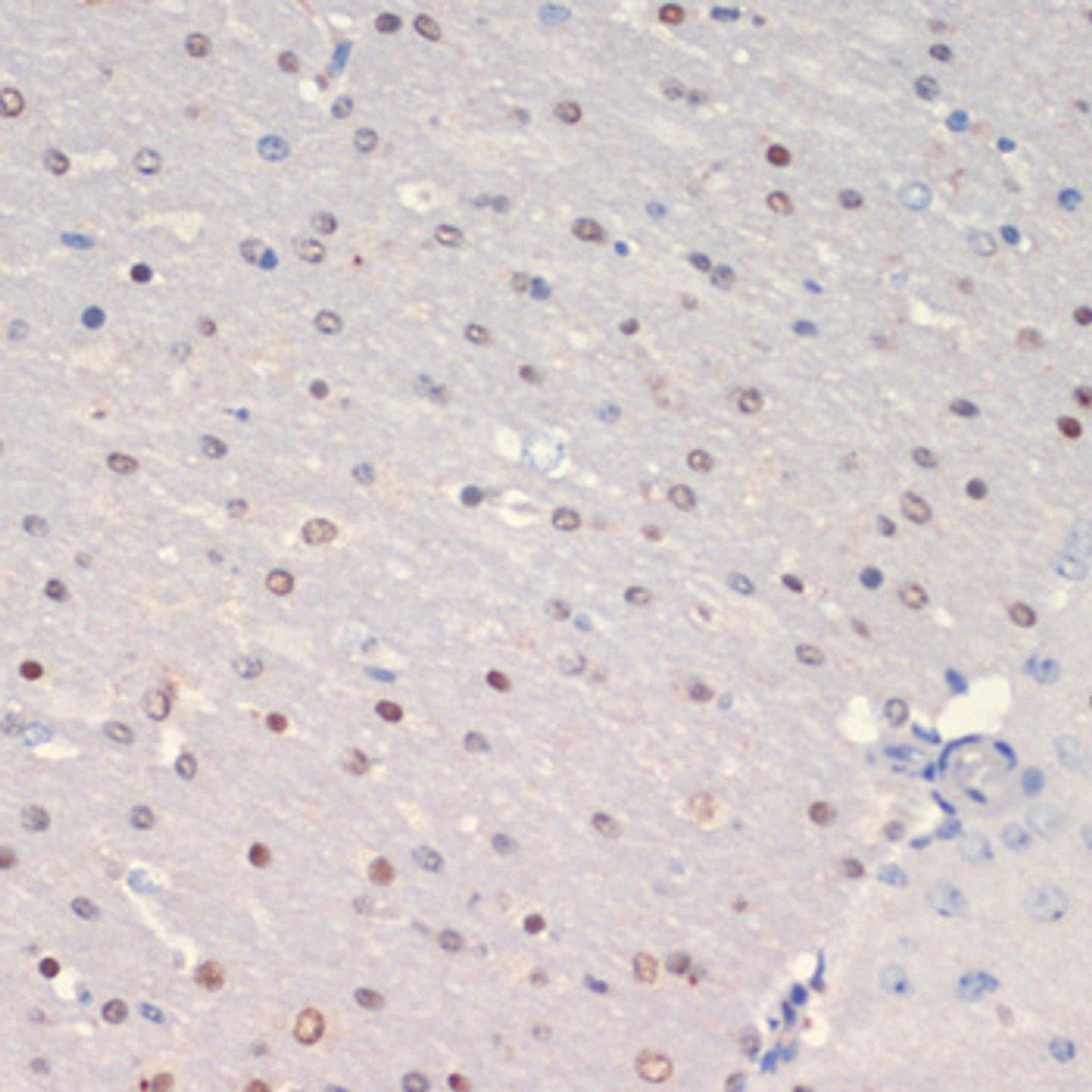 Immunohistochemistry of paraffin-embedded Mouse brain using OLIG2 Polyclonal Antibody at dilution of  1:200 (40x lens).