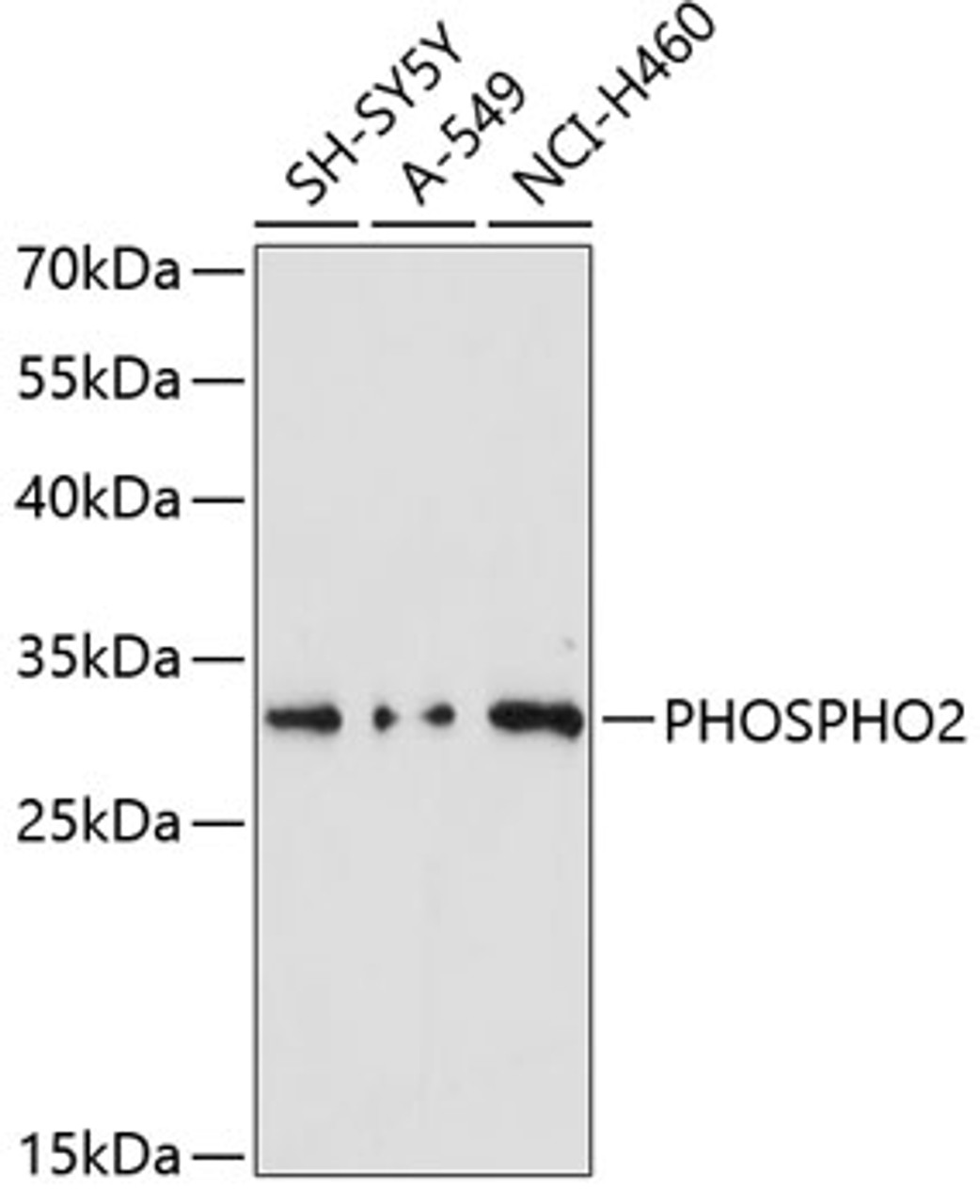 Western blot analysis of extracts of various cell lines using PHOSPHO2 Polyclonal Antibody at dilution of 1:3000.