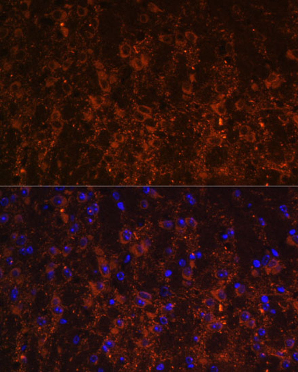 Immunofluorescence analysis of Mouse brain using SNX13 Polyclonal Antibody at dilution of  1:100. Blue: DAPI for nuclear staining.