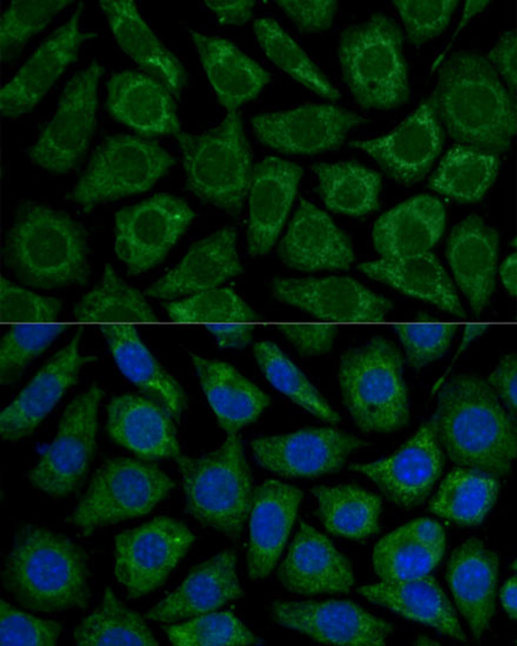 Immunofluorescence analysis of L929 cells using NDUFS2 Polyclonal Antibody at dilution of  1:100. Blue: DAPI for nuclear staining.