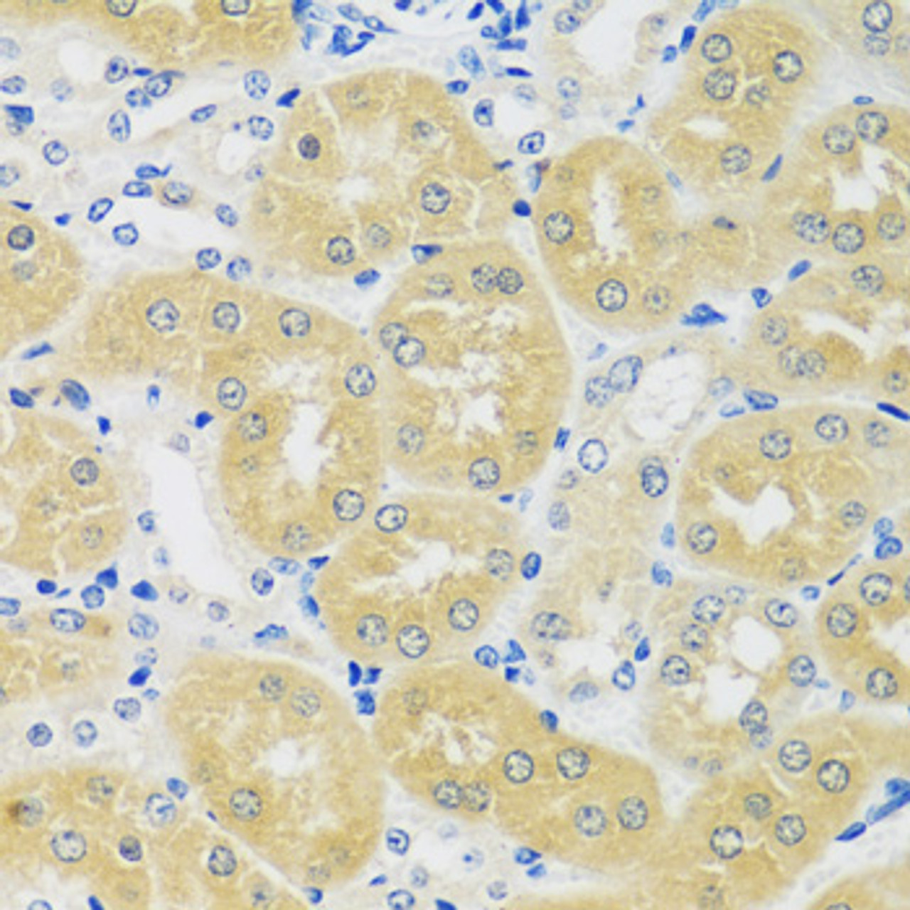 Immunohistochemistry of paraffin-embedded Mouse kidney using C1GALT1 Polyclonal Antibody at dilution of  1:100 (40x lens).