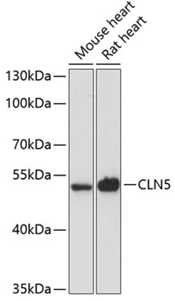Western blot analysis of extracts of various cell lines using CLN5 Polyclonal Antibody at dilution of 1:3000.