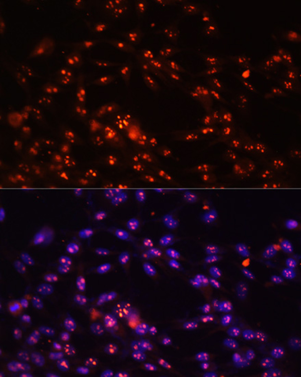 Immunofluorescence analysis of NIH-3T3 cells using DKC1 Polyclonal Antibody at dilution of  1:100. Blue: DAPI for nuclear staining.
