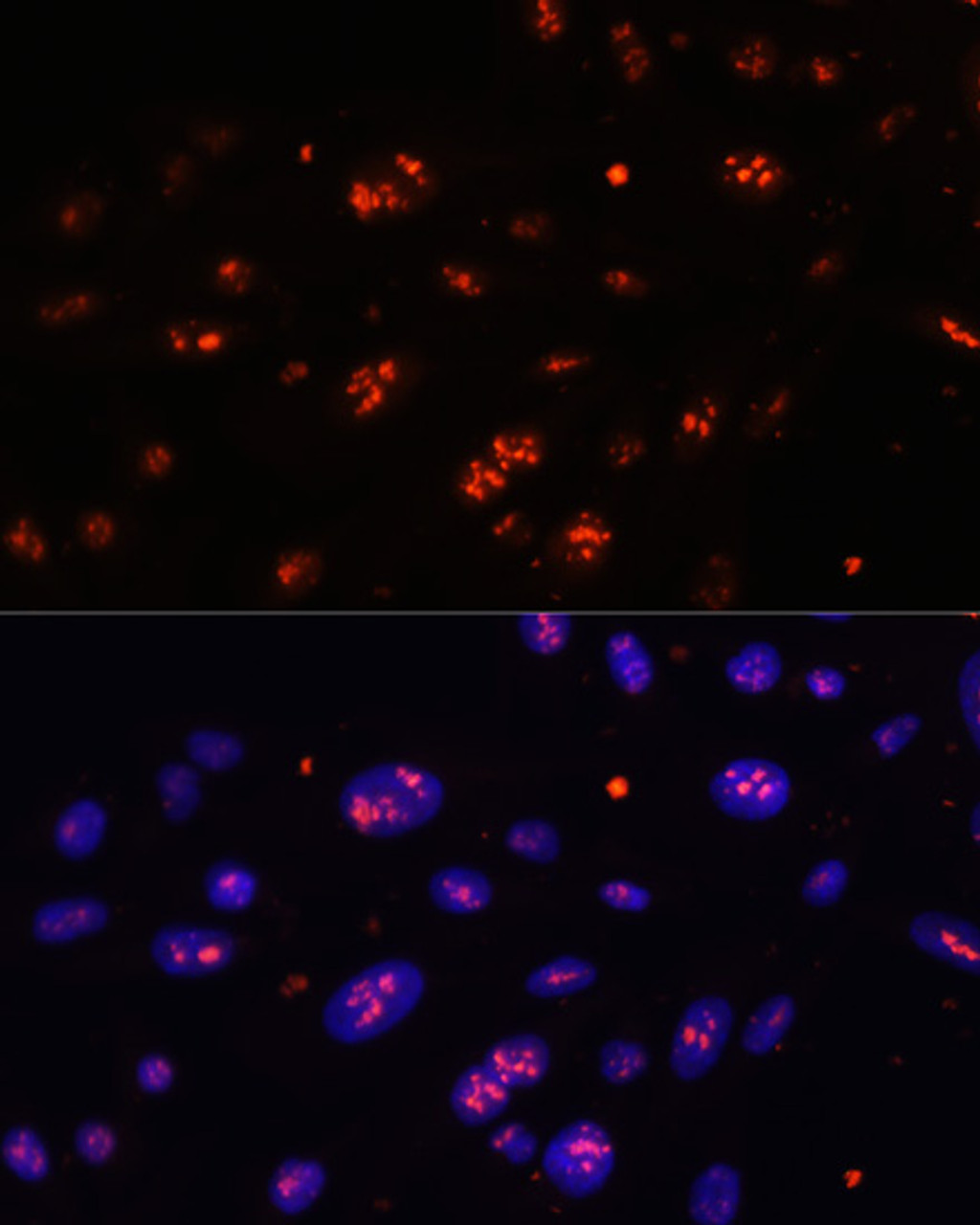 Immunofluorescence analysis of U-2 OS cells using DKC1 Polyclonal Antibody at dilution of  1:100. Blue: DAPI for nuclear staining.