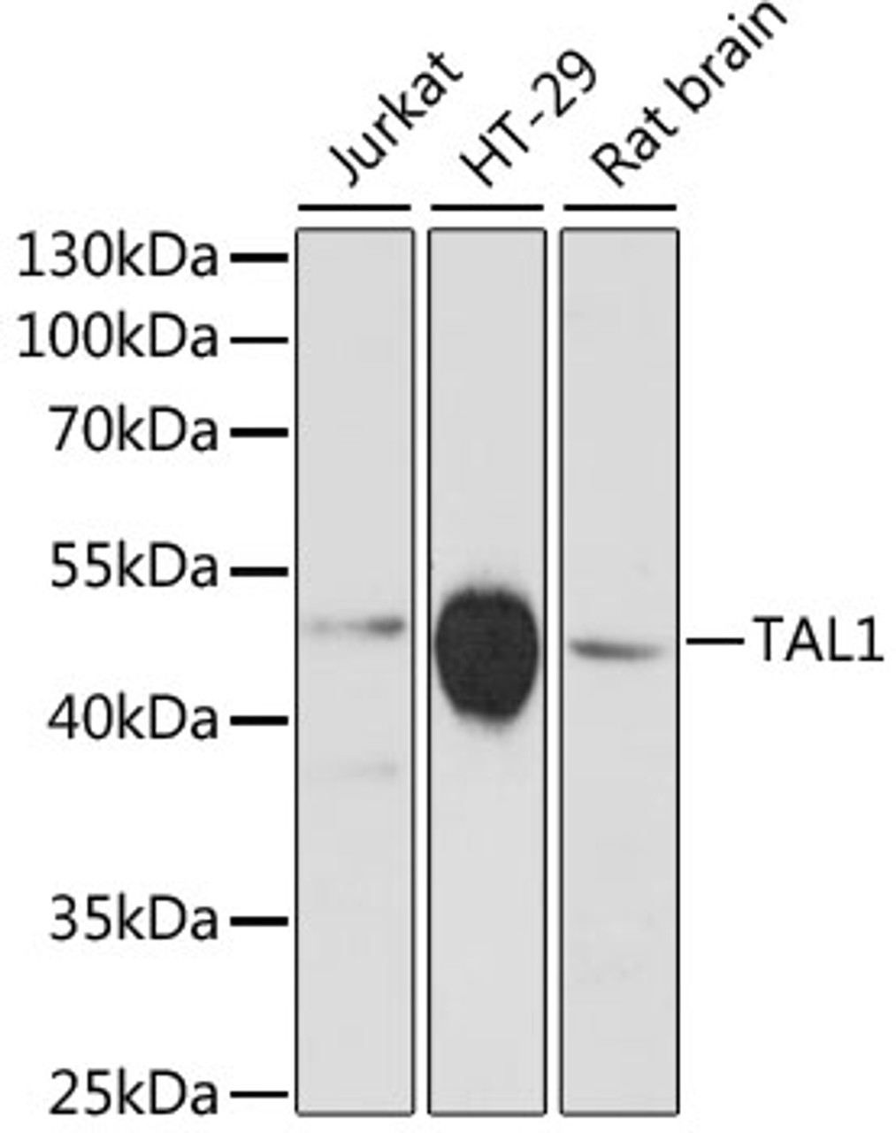 Western blot analysis of extracts of various cell lines using TAL1 Polyclonal Antibody at dilution of 1:3000.