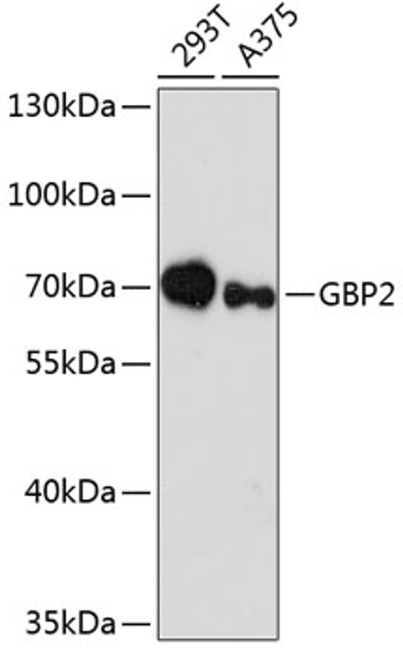 Western blot analysis of extracts of various cell lines using GBP2 Polyclonal Antibody at dilution of 1:3000.