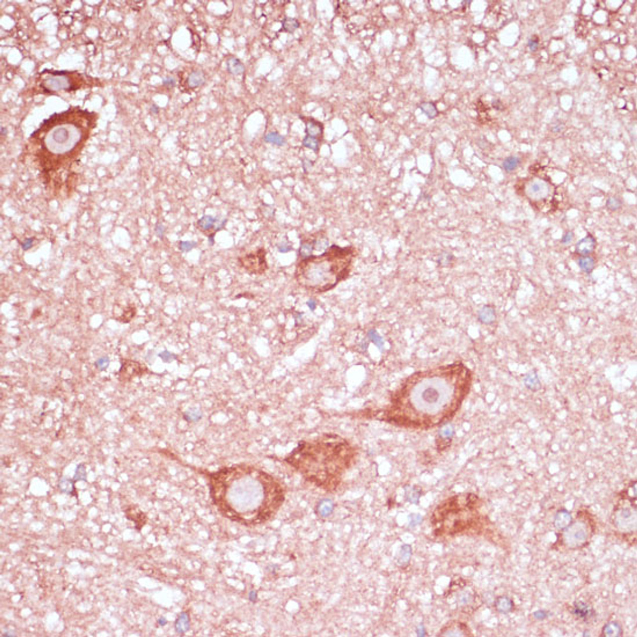 Immunohistochemistry of paraffin-embedded Mouse spinal cord using RPL32 Polyclonal Antibody at dilution of  1:100 (40x lens).