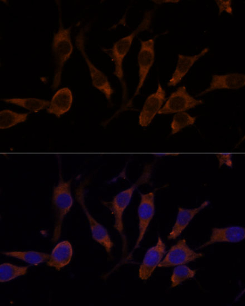 Immunofluorescence analysis of L929 cells using RPL32 Polyclonal Antibody at dilution of  1:100 (40x lens). Blue: DAPI for nuclear staining.