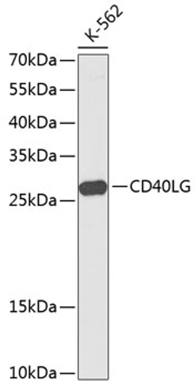 Western blot analysis of extracts of K561 cells using CD40L Polyclonal Antibody at dilution of 1:1000.