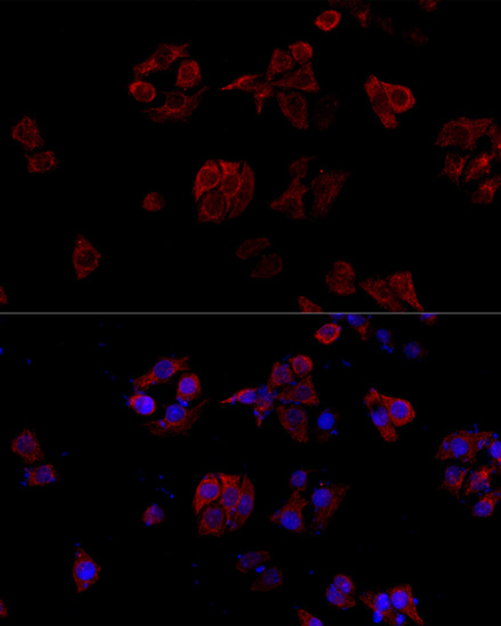 Immunofluorescence analysis of HeLa cells using CD40L Polyclonal Antibody at dilution of  1:100. Blue: DAPI for nuclear staining.