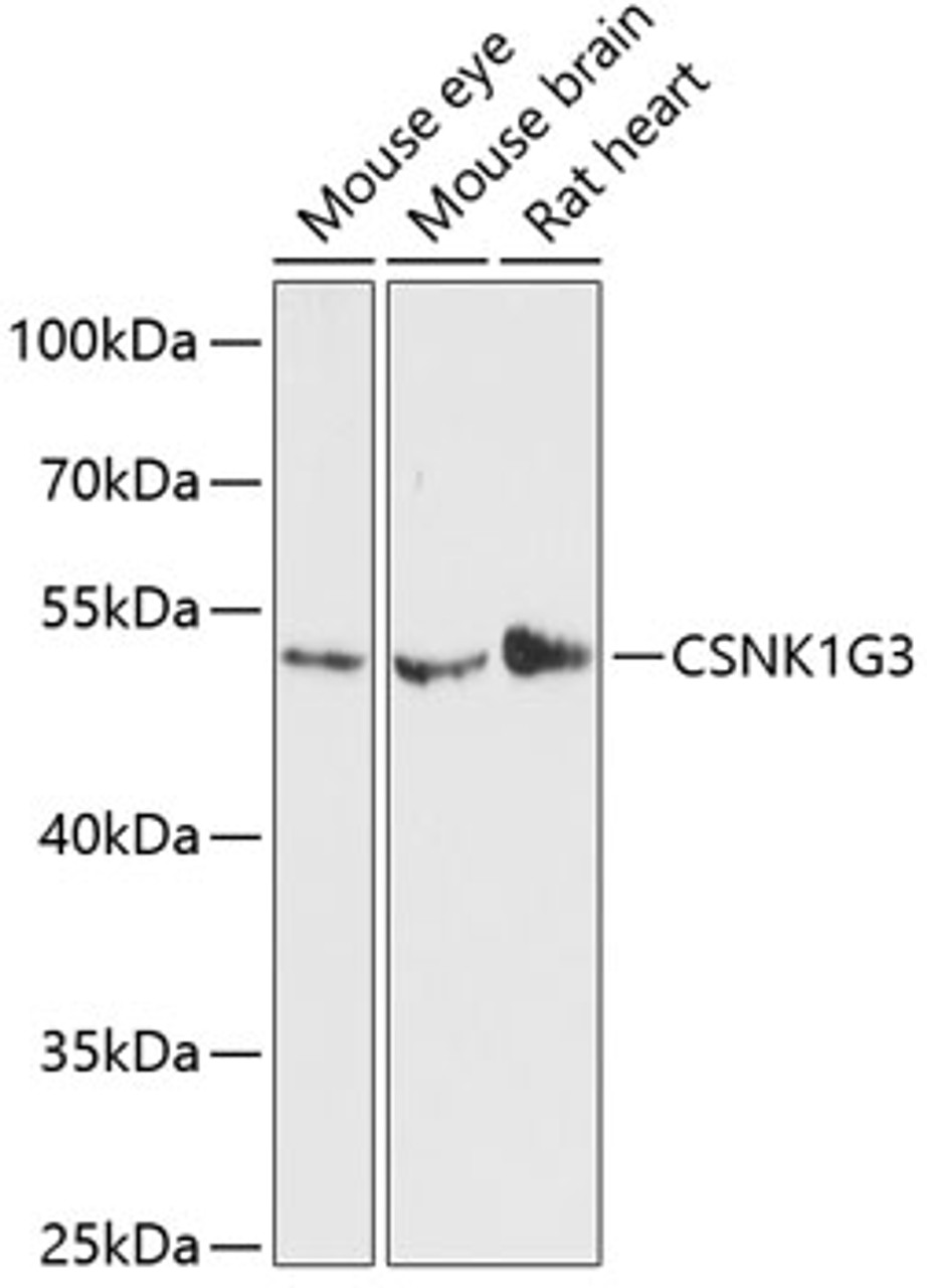 Western blot analysis of extracts of various cell lines using CSNK1G3 Polyclonal Antibody at dilution of 1:3000.