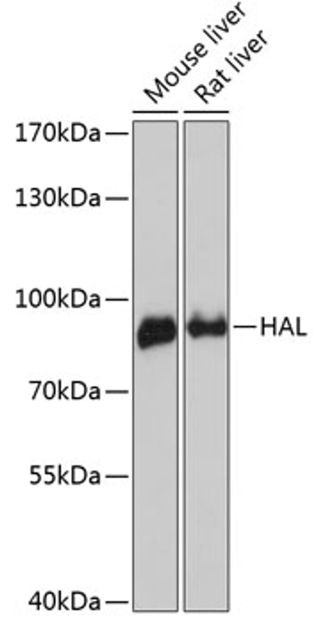 Western blot analysis of extracts of various cell lines using HAL Polyclonal Antibody at dilution of 1:3000.