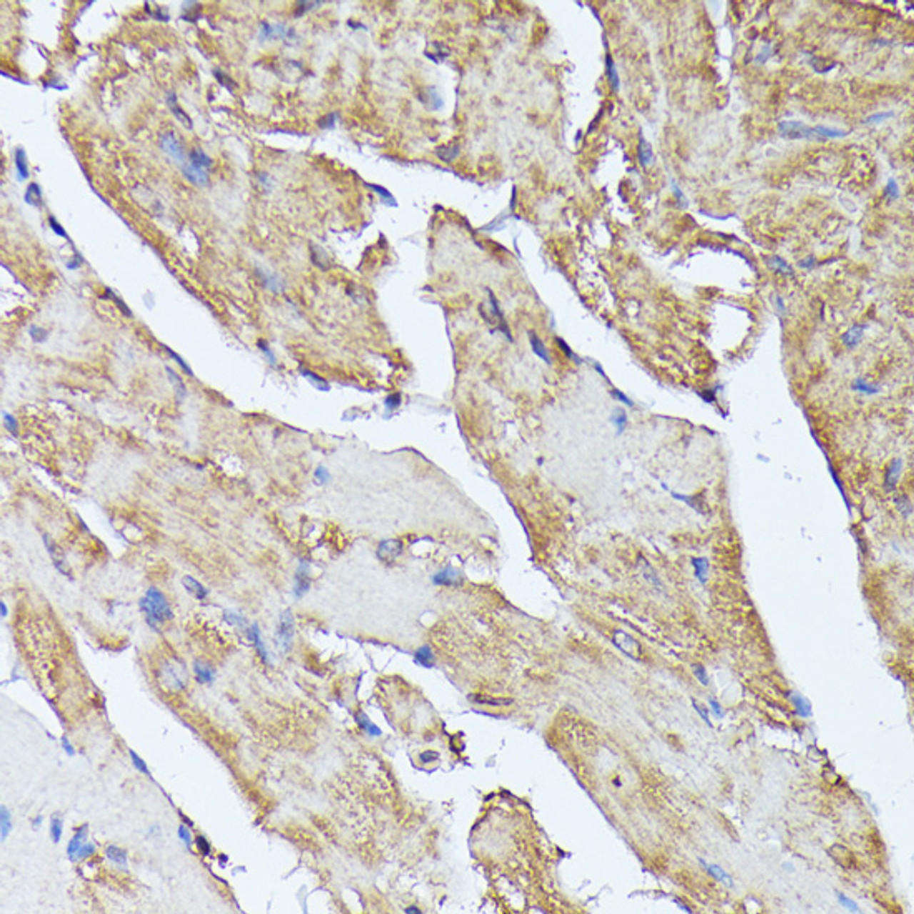 Immunohistochemistry of paraffin-embedded Mouse heart using HAL Polyclonal Antibody at dilution of  1:100 (40x lens).