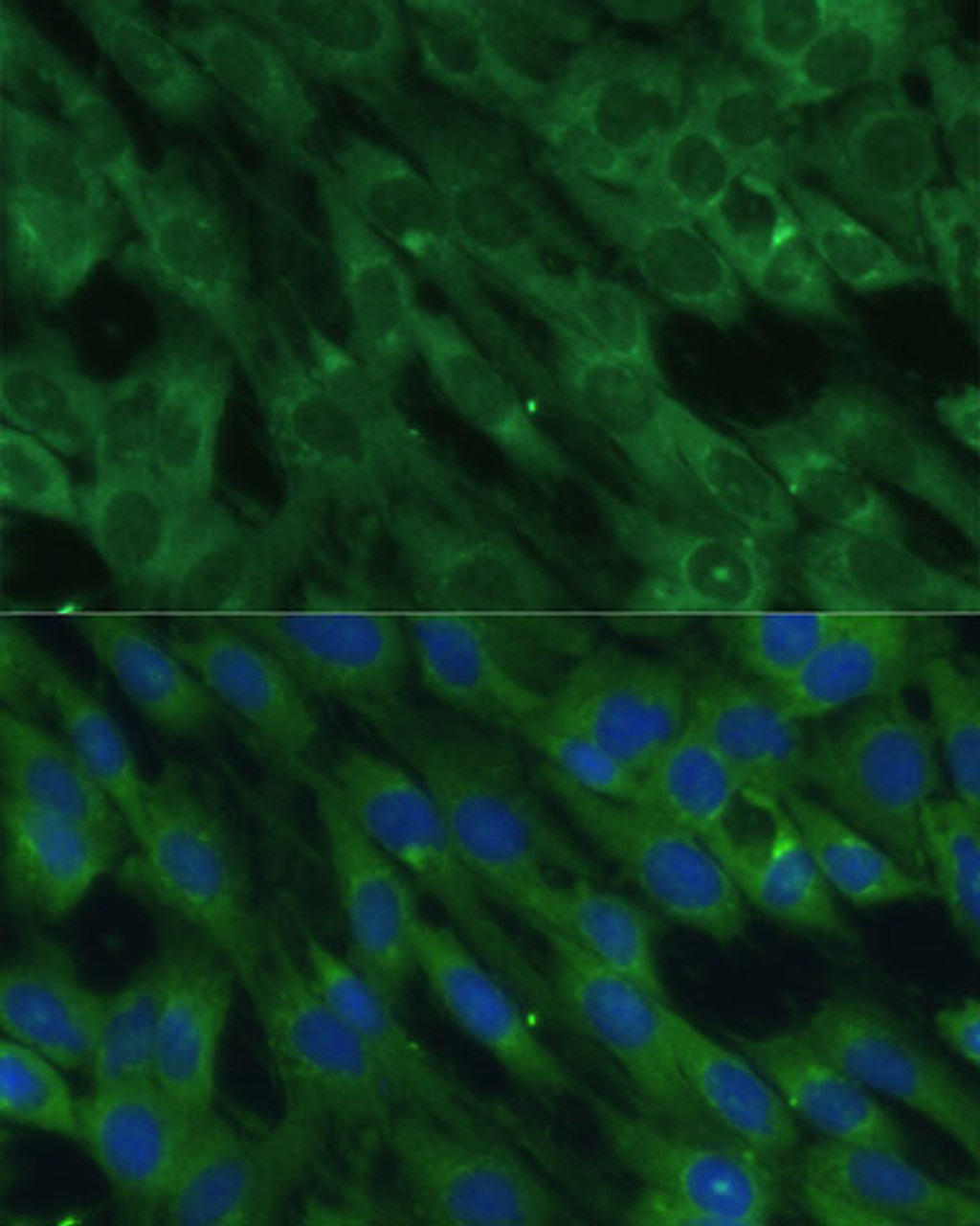Immunofluorescence analysis of C6 cells using HAL Polyclonal Antibody at dilution of  1:100 (40x lens). Blue: DAPI for nuclear staining.