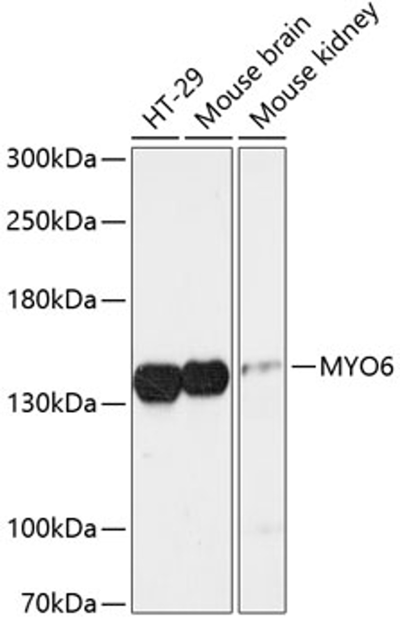 Western blot analysis of extracts of various cell lines using MYO6 Polyclonal Antibody at dilution of 1:3000.