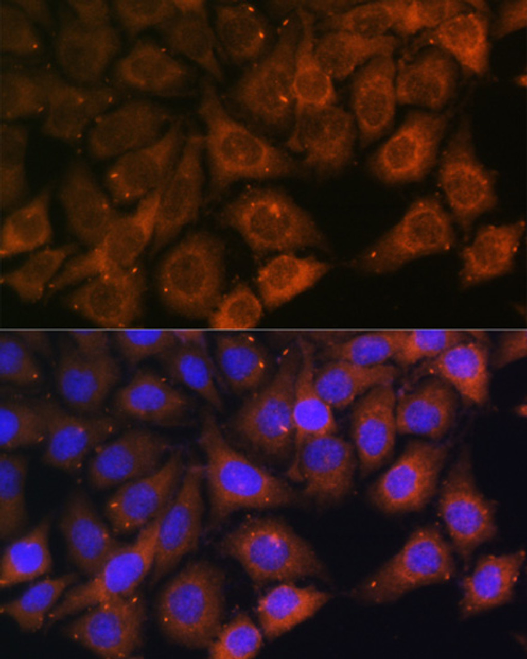 Immunofluorescence analysis of HeLa cells using MYO6 Polyclonal Antibody at dilution of  1:100. Blue: DAPI for nuclear staining.