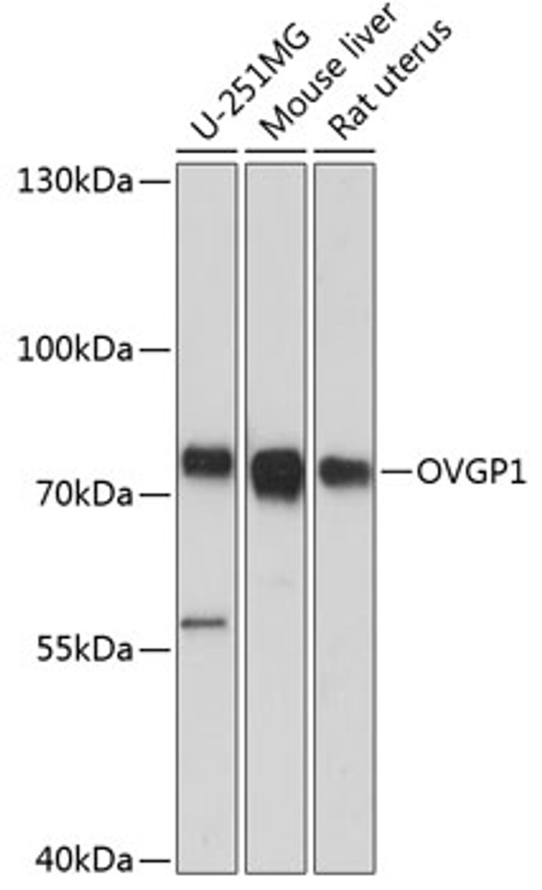 Western blot analysis of extracts of various cell lines using OVGP1 Polyclonal Antibody at dilution of 1:3000.