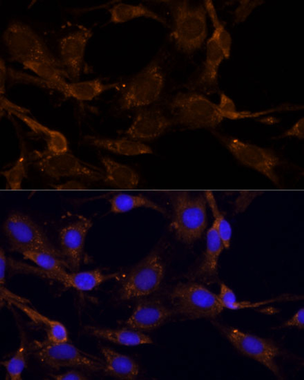 Immunofluorescence analysis of C6 cells using RPL27 Polyclonal Antibody at dilution of  1:100 (40x lens). Blue: DAPI for nuclear staining.