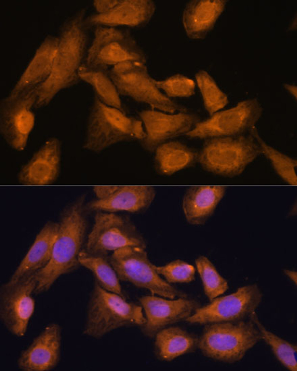 Immunofluorescence analysis of U-2 OS cells using RPL27 Polyclonal Antibody at dilution of  1:100 (40x lens). Blue: DAPI for nuclear staining.
