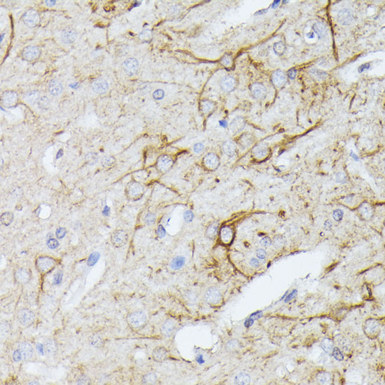 Immunohistochemistry of paraffin-embedded Rat brain using TBCA Polyclonal Antibody at dilution of  1:100 (40x lens).